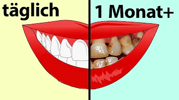 Was passiert wenn man sich nur abends die Zähne putzt?