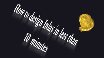 How to design inlay in exocad