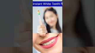 Baking Soda Teeth Whitening Hack! 🔥 #beautyshorts