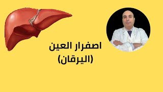 اسباب اصفرار العينين عند الكبار وعلاجها