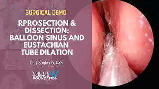 Prosection & Dissection  Balloon Sinus and Eustachian Tube Dilation - Douglas D. Reh, M.D.