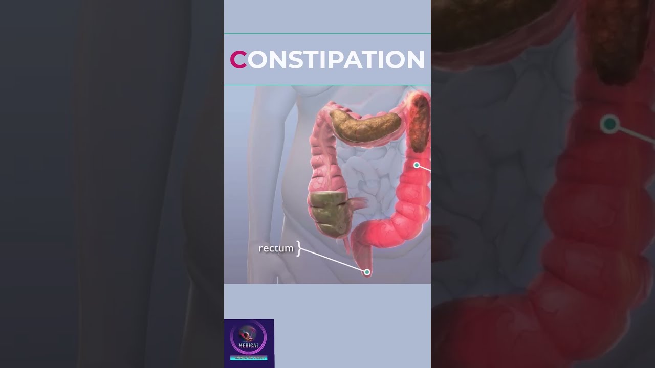 Constipation Shorts