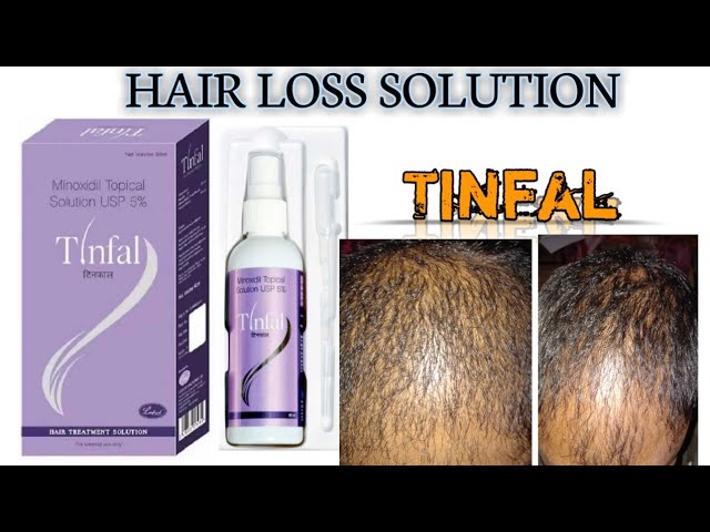 TINFAL F HAIR TREATMENT SOLUTION 60ML 2PCS Hair Oil