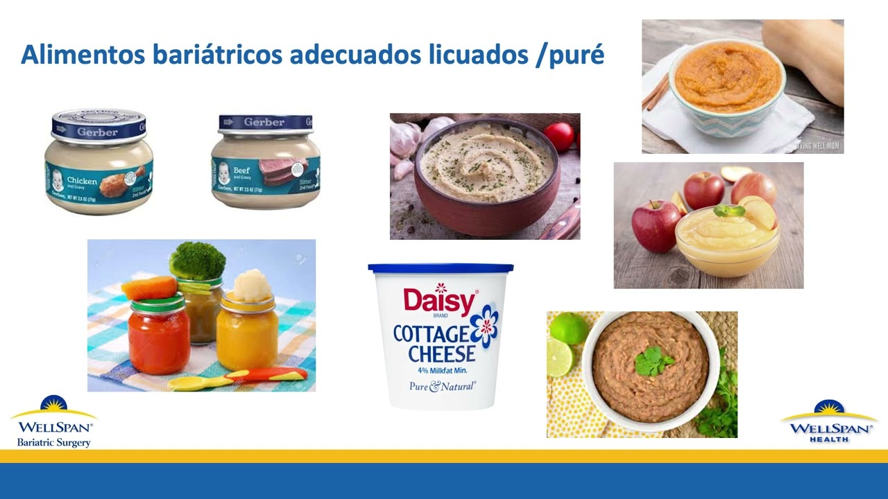Cirugía Bariátrica de WellSpan Sesión de Nutrición #5 - Dieta de Transición Postquirúrgica