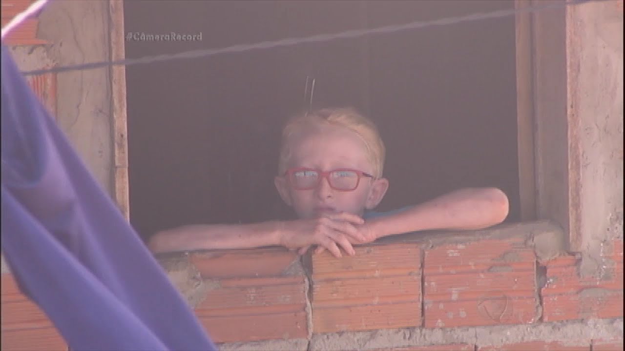 Prisioneiro no deserto: menino albino só sai de casa ao anoitecer