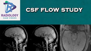 csf flow study