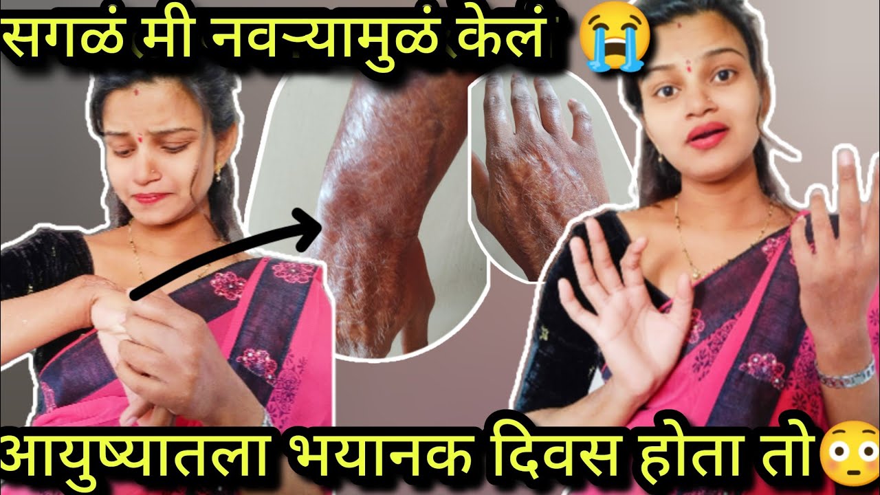 आठवल तरी रडायला येतंय😭पण का सगळेजण नवऱ्याला दोषी ठरवतात🥺तो फक्त एक एक्सीडेंट होता🥺न विसरणारा तो दिवस