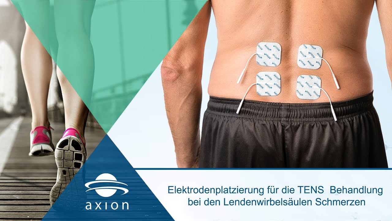 Lendenwirbelsäulen-Schmerzen - Elektrodenplatzierung für TENS | axion -  YouTube