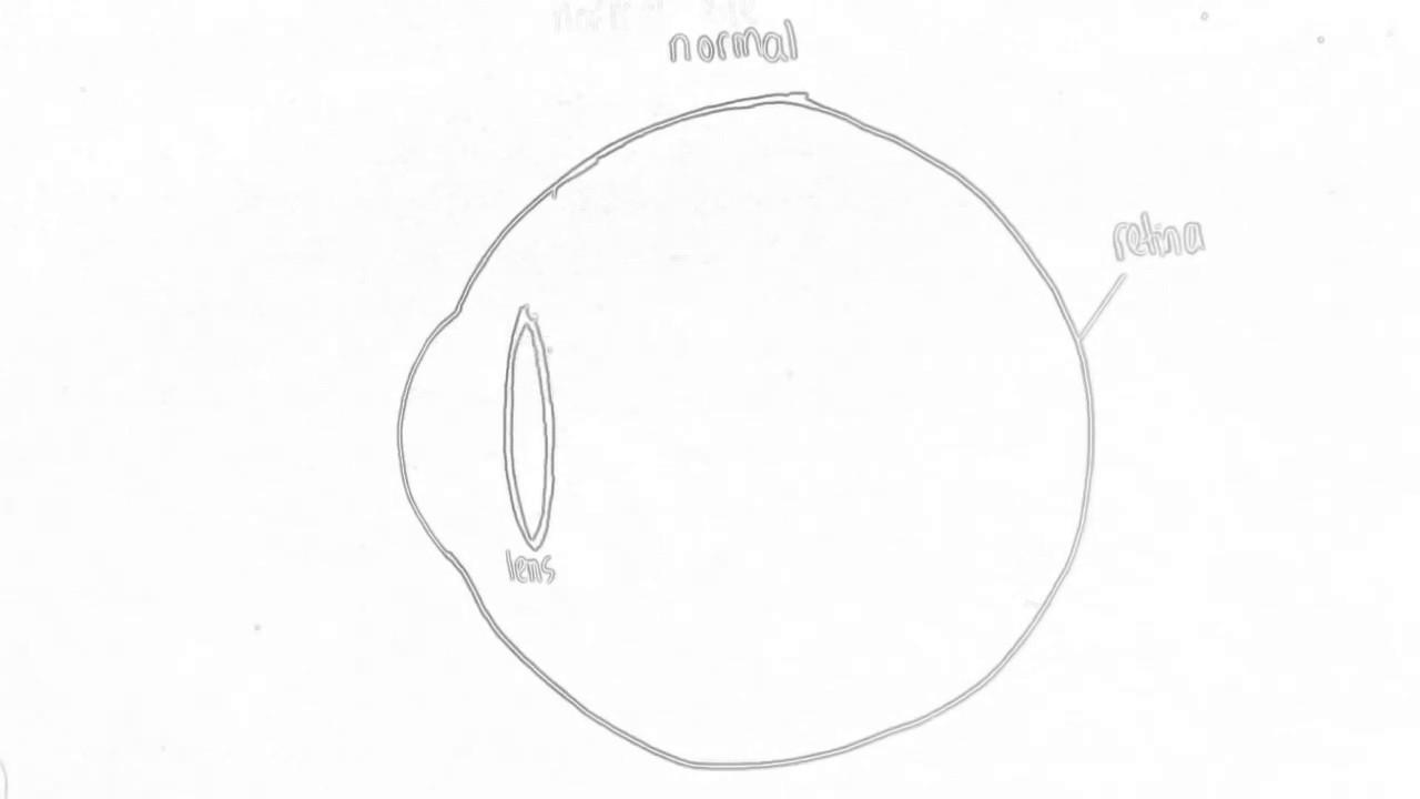 patkó látásvizsgálati diagram