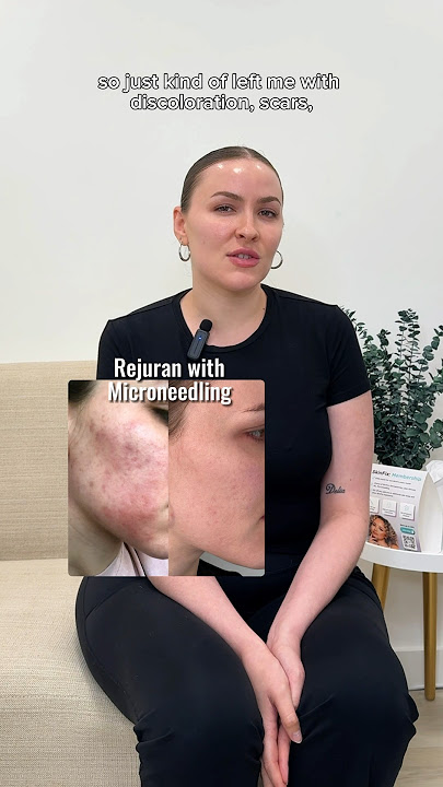 Salmon DNA is all the rage at BeautyFix! 🐟 #rejuran #salmondna #skincare #kbeauty #microneedling