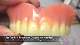 Denture Tooth Repair with Matrix