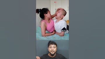 Faded Song | Conjoined Twins#shorts#disabled#viral