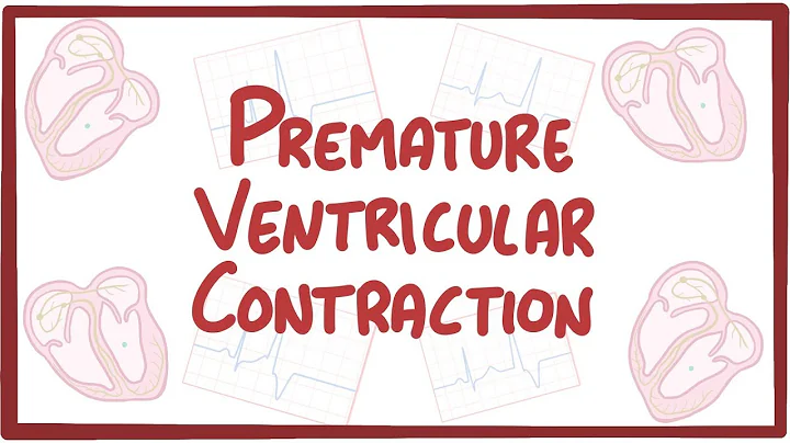 Premature Ventricular Contraction - causes, symptoms, diagnosis, treatment, pathology