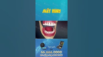 [3D] MẤT RĂNG || Nha Khoa Quốc Tế Athena