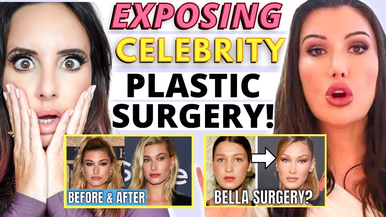 How Lorry Hill's Innovative Channel Exposed Celebrity Plastic Surgery -  Erika Vieira