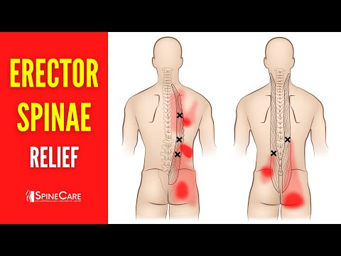 Video: Doen die erector spinae?