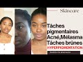 SOINS ANTI TÂCHES /l hyper pigmentation Comment Combattre Part 1 #2020