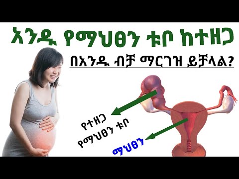 አንዱ የማህፀን ቱቦ ከተዘጋ በአንዱ ብቻ ማርገዝ ይቻላል?የማህፀን ቱቦ| One fallopian tube blocked possible to pregnant others