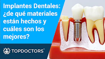 ¿De qué están hechos los mejores implantes dentales?