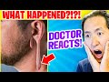 Plastic Surgeon Reacts to TORN Gauge Earlobe!