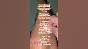 Rashes Benefits Infection 