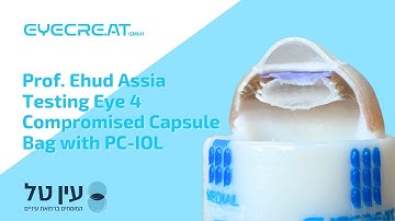 Prof. Ehud Assia Testing Eye 4 Compromised Capsule Bag with PC-IOL