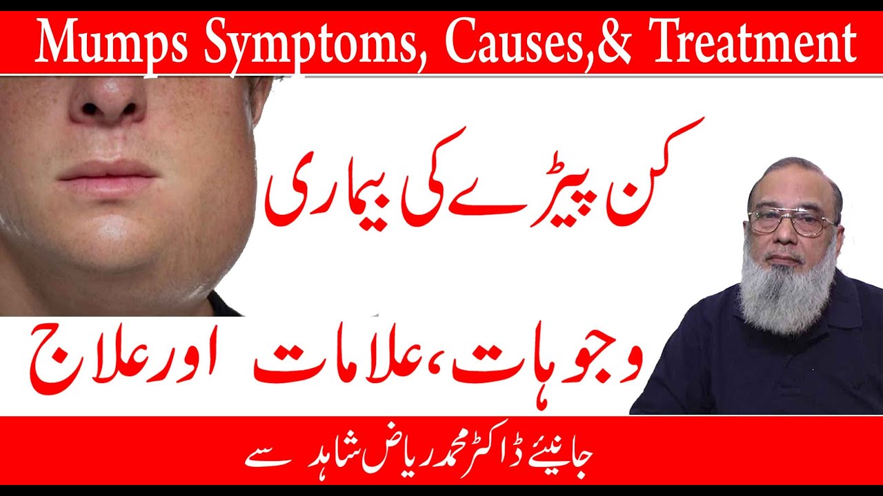 Mumps Treatment in Urdu YouTube