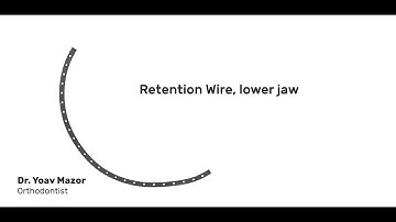 How to Use the Lingual Retention Wire Set - Strauss Diamond