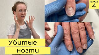 Будни мастера маникюра | Повреждённые ногти КАК БЫТЬ? Педикюр с сюрпризом