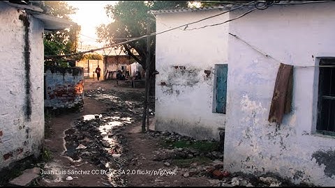 Epidemiology and visual impairment