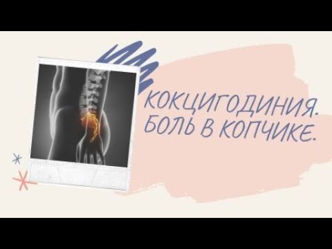 КОКЦИГОДИНИЯ / БОЛЬ В КОПЧИКЕ.