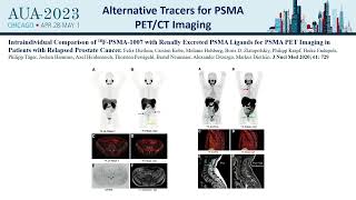 How To Use Psma-Petct In The Management Of Relapsing Prostate Cancer Patients Webcast 2023