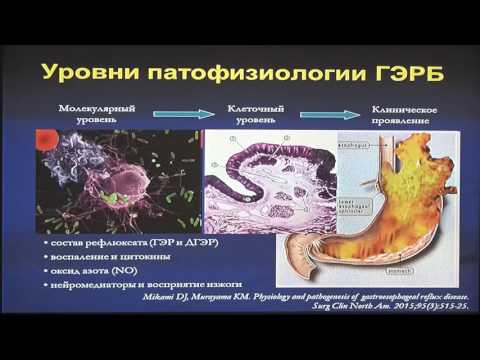 30Маев ИВ Факторы агрессии и защиты слизистой пищевода в патогенезе ГЭРБ