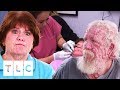 Siblings With Rare Skin Condition Seek Dr. Lee's Help | Dr. Pimple Popper: This Is Zit