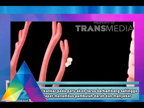 Video: E3 Ubiquitin Ligase NEDD4 Memediasi Pensinyalan Migrasi Sel EGFR Dalam Sel Kanker Paru-paru