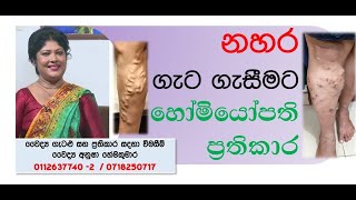 නහර ගැට ගැසීමට හෝමියෝපති ප්‍රතිකාර -Dr.Anusha Hemakumara -Piyum Vila 2021.04.29