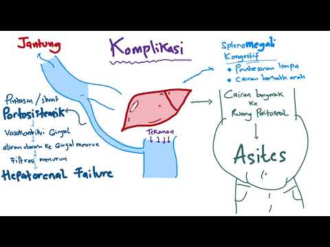 Patofisiologi - Sirosis Hepatis / Hepatic Chirrosis