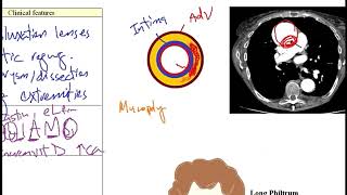 USMLE ACE Video 27: Genetic and Congenital Syndromes: Causes and Clinical Features