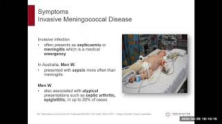 Immunisation Coalition: 2020 Meningococcal Disease Webinar