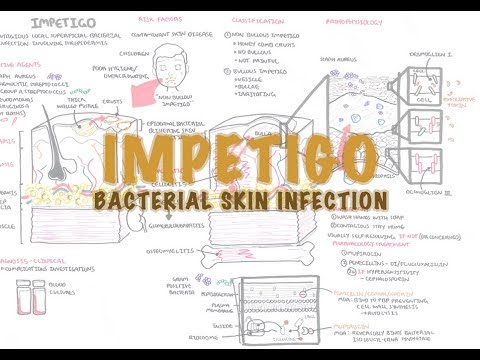 Impetigo Bacterial Skin Infection - Overview (Clinical Presentation, Pathophysiology, Treatment)