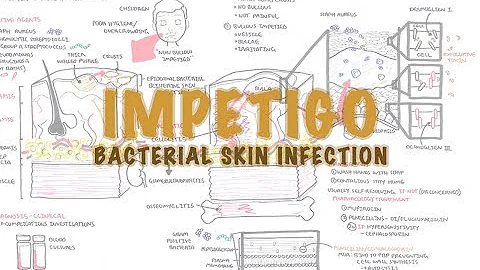 Quali sono le forme di impetigine?