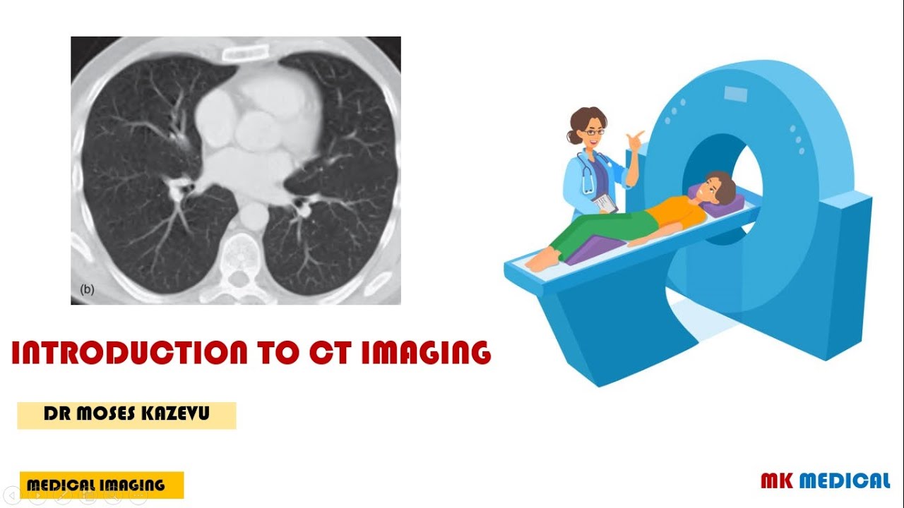 CT Scans How to interpret CT scans Part 1 basics YouTube