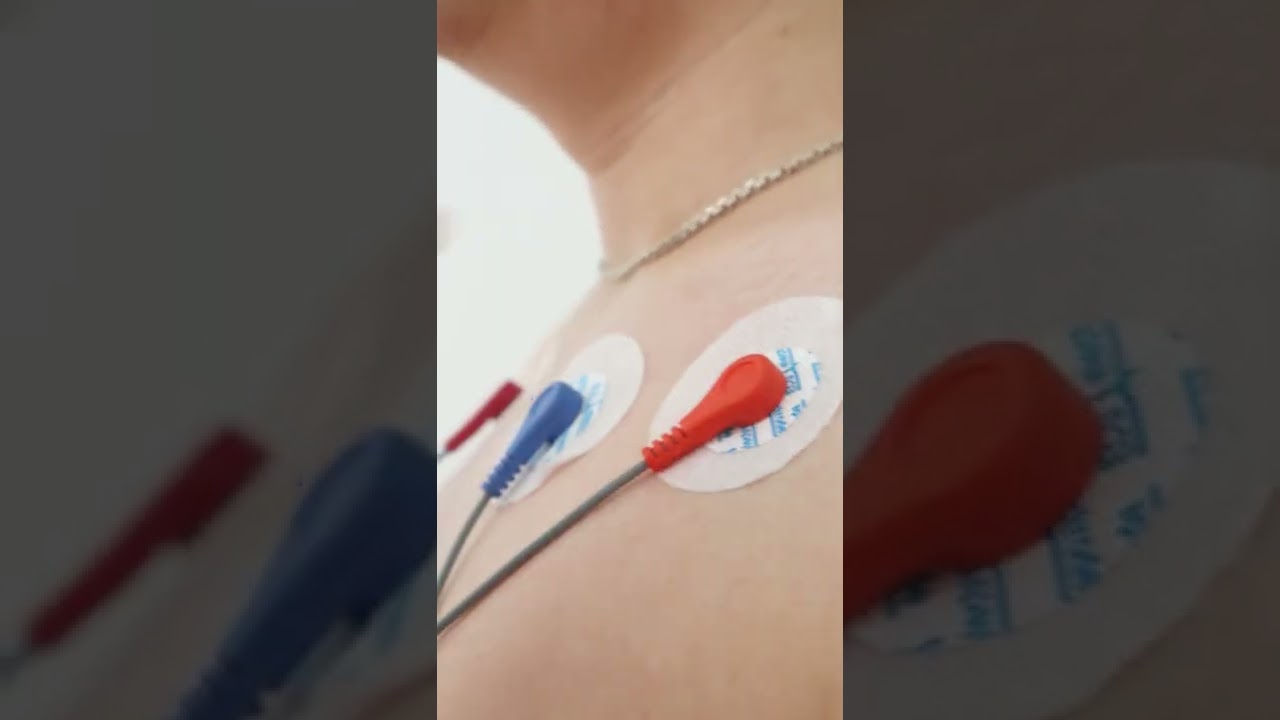 холтеровское суточное мониторирование ЭКГ