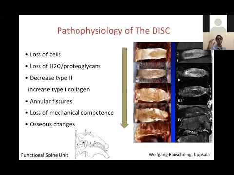 Video: Mengapa osteotom dicipta?