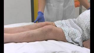 2 Static Quadriceps