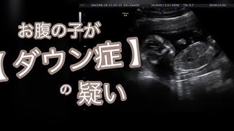 胎児 Youtube 胎児 Youtube