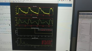 Pulse Rate Variability, Heart Rate, Blood Pressure Estimation Using PPG signal.