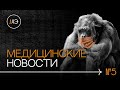 Обезьянья оспа. Вспышка гепатита в США. Нас ждет новая эпидемия?  | Новости#5