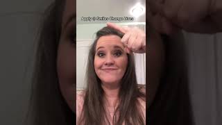 How to get FREE 💰💵 braces