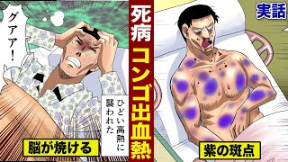 【実態】コンゴ出血熱の恐怖…全身が紫色になる。致死率４０%の死病。